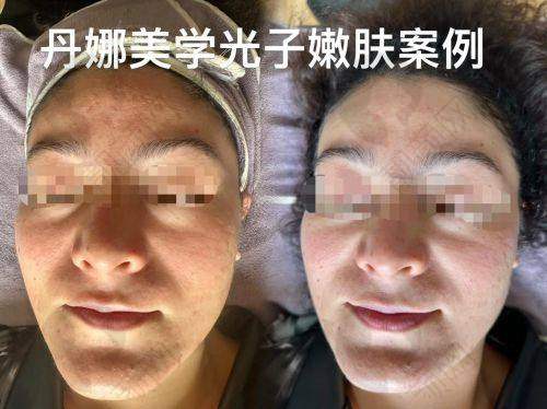 襄阳韩美光子嫩肤医生团队