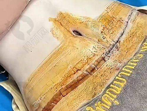 吉林医疗美容门诊部：简约美学，专属定制