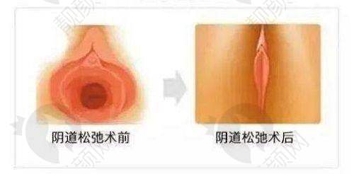 一、深圳安美聚光医疗美容门诊部怎么样？