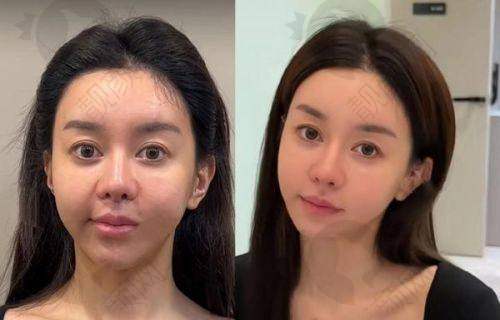 二、哈尔滨月几国内外医美中 心正规吗？来看看医院资质：