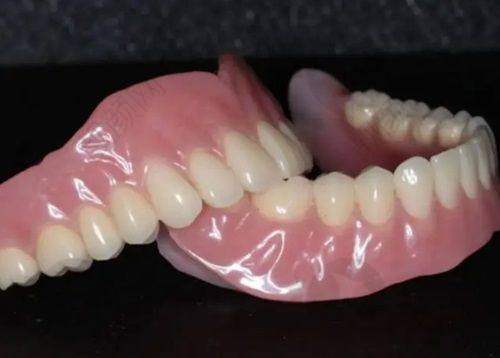 上海薇琳口腔种植医生实力大展示