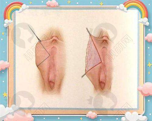 沈阳京科私密整形医院的正规资质