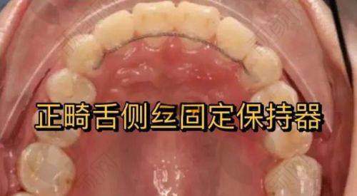 广州穗华口腔孔卫东医生：舌侧矫正领域的领军人物