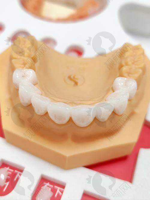 瑞士西捷美牙冠：用户评价好不好？