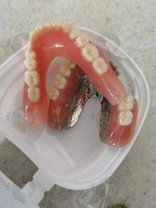 上海英博口腔正规靠谱