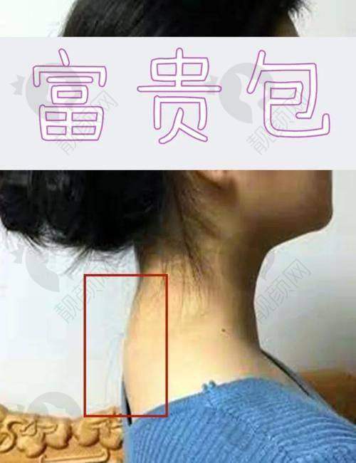 叶桐江项目价格表参考
