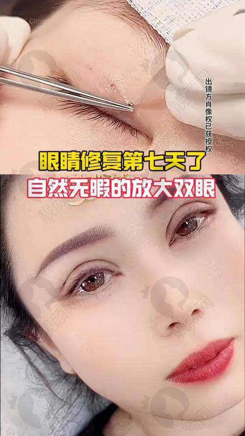 林靖医生：资质齐全技术强