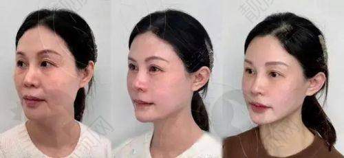 崔晶莹在哪家医院