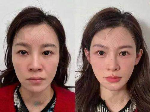 李花停项目价格表参考