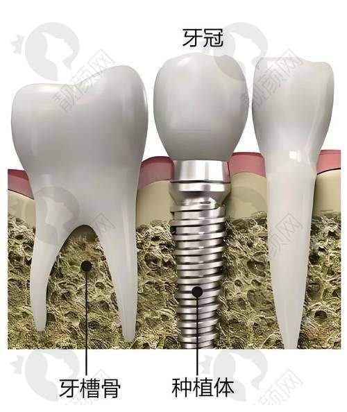 长春环球口腔门诊部：规模较大，数字化种植理念精良