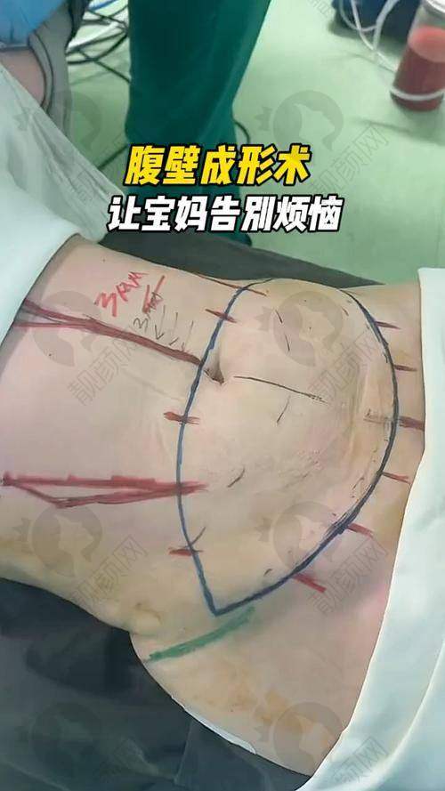 西安崔鑫在哪家医院