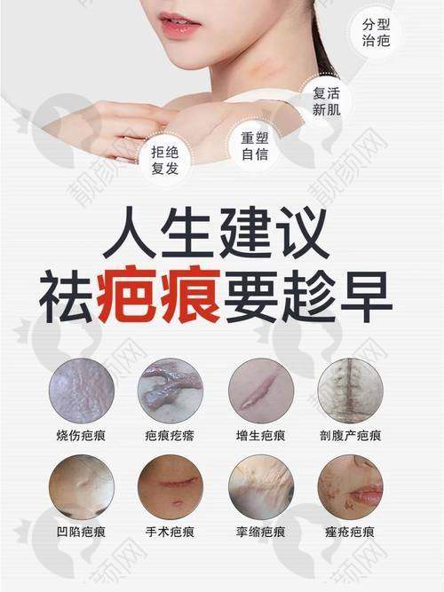 上海华美医院疤痕科：AI智能磨削显神通