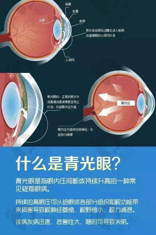 株洲做青光眼的眼科医院有哪些？株洲爱尔与仁和医院基本情况大揭秘