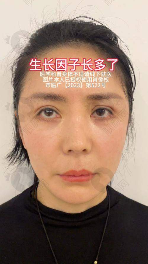 谁说王绍国取生长因子特别贵？美雅枫、爱多邦口碑双优