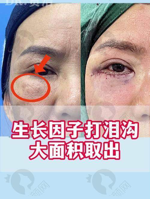 谁说王绍国取生长因子特别贵？美雅枫医院优势尽显