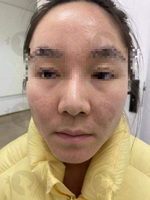 谁说王绍国取生长因子特别贵？王绍国医生实力揭秘