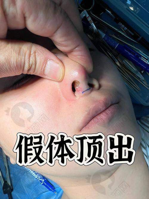 北京沃尔刘彦军在哪家医院