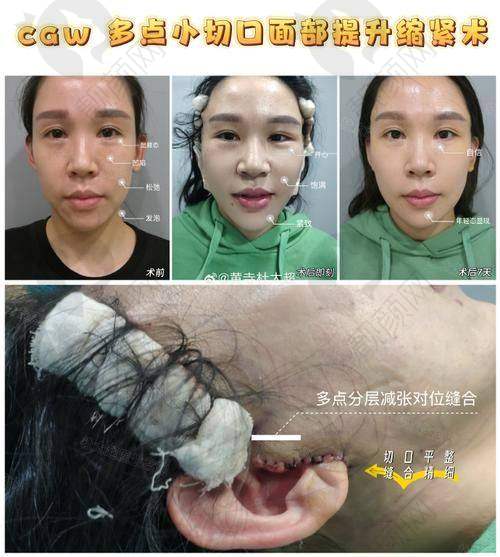 选有好口碑的医院，让人更安心