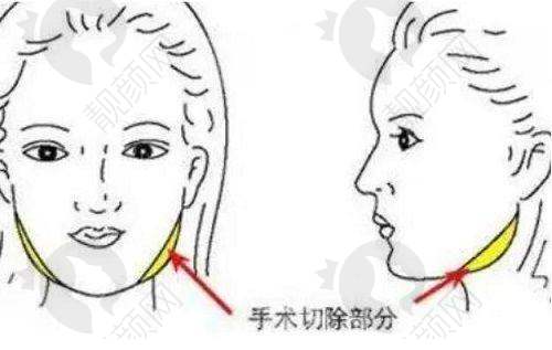 六、汉中韩美整形美容医院实例：