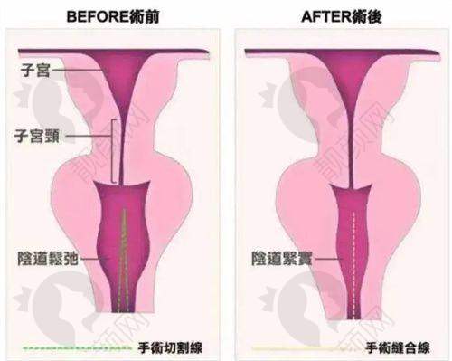 一、成都市第二人民医院医疗美容科怎么样？