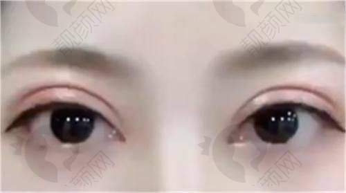 北京画美医院的医生团队特别靠谱