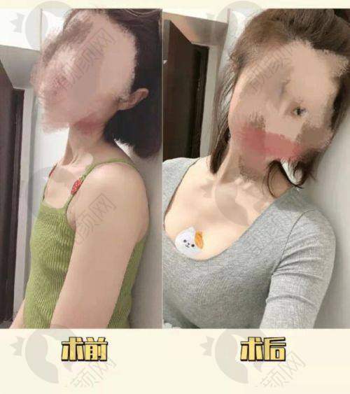 梁耀婵怎么预约？