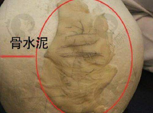 一、汉中韩美整形美容医院怎么样？