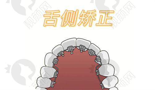 广州穗华口腔黄海霞在哪家医院