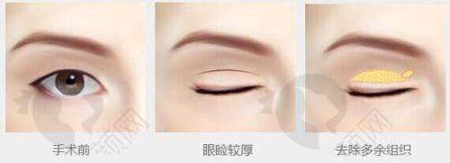 七、汉中韩美整形美容医院怎么预约：