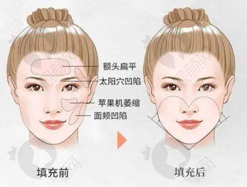 华中科技大学医学校附属第一医院整形外科怎么样？专精齐全经验多