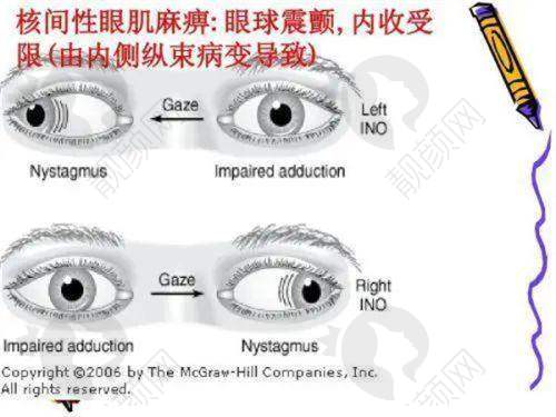 成都普瑞眼科医院的精良技术实力