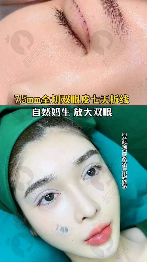 林靖怎么预约？