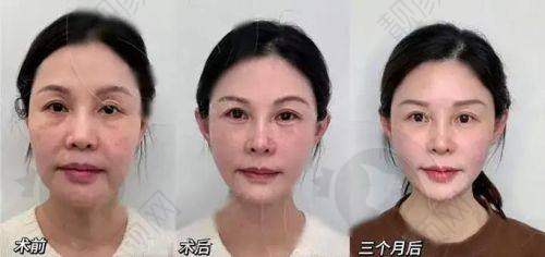 如何避开低价陷阱
