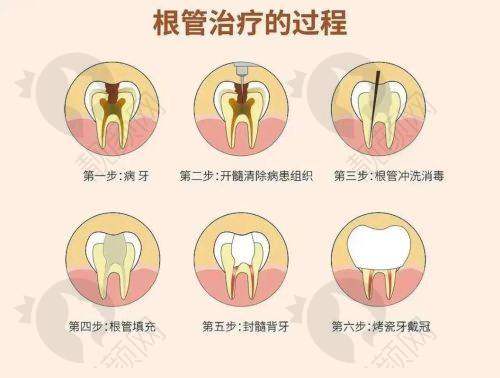 李秋红口腔牙周病诊疗水平怎么样？