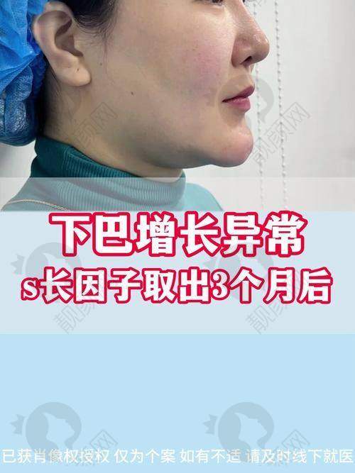 广州荔医余东文医生介绍