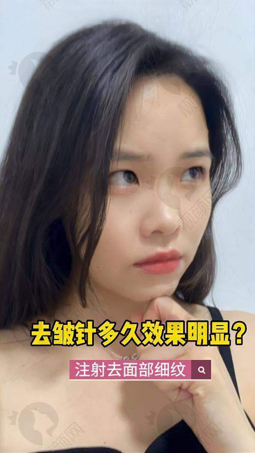 广州曙光张小芸医生介绍