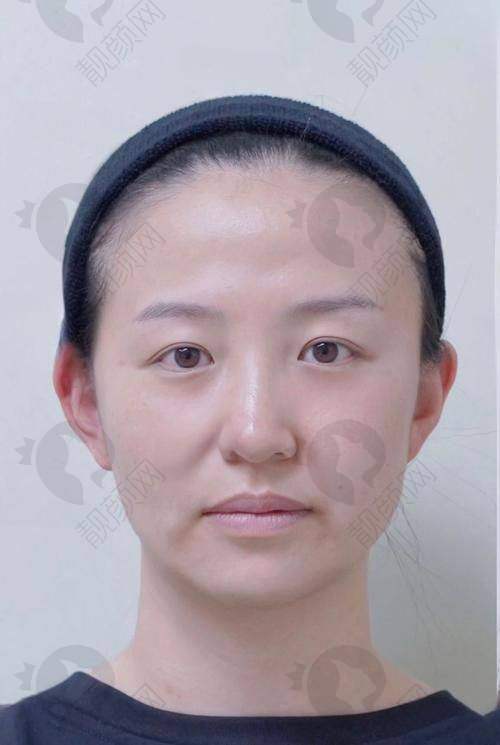 王金洲亲诊，技术实力杠杠的