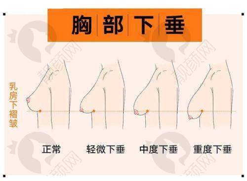许幼永吸脂项目价格表参考