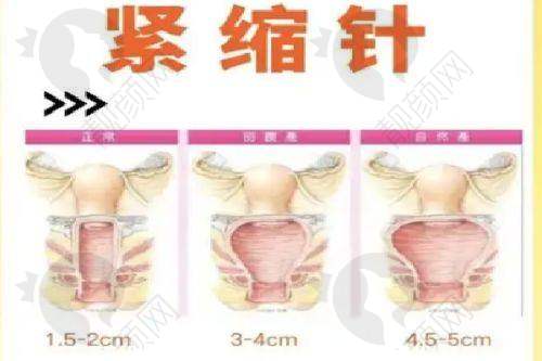 黑龙江超龙医疗美容医院怎么样?广泛开展项目,满足多样需求