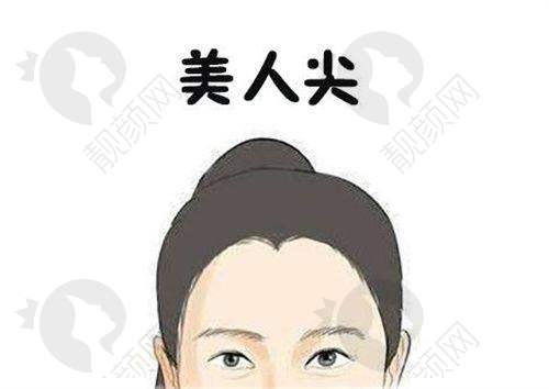 碧莲盛NHT不剃发技术：优势显著超贴心