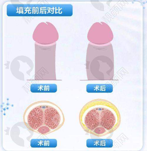 黑龙江超龙医疗美容医院怎么样?合理价格体系,透明消费更安心