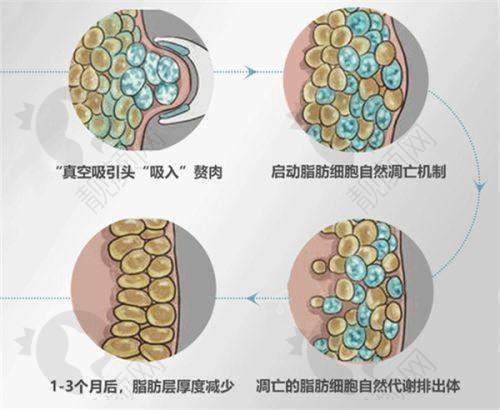 全新沈阳杏林美容院整形医院眼部整形价格差异原因