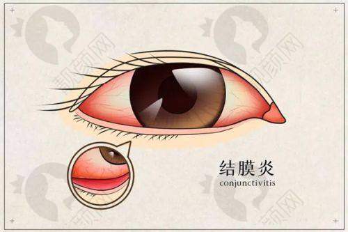 兰州爱尔眼科:医生团队实力强,经验多