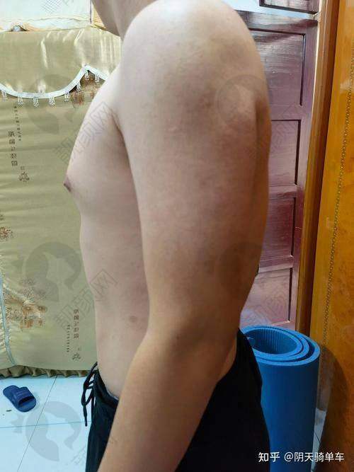 韩国入珠价格大揭秘！入珠方式和注意事项