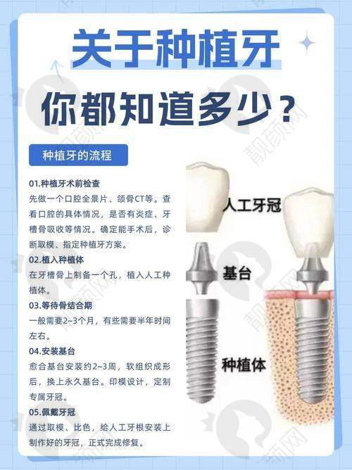 上海鼎植马列怎么预约？
