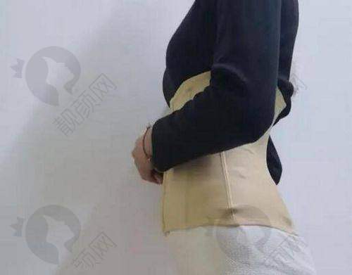 成都艾米丽医疗美容腰部吸脂真实评价
