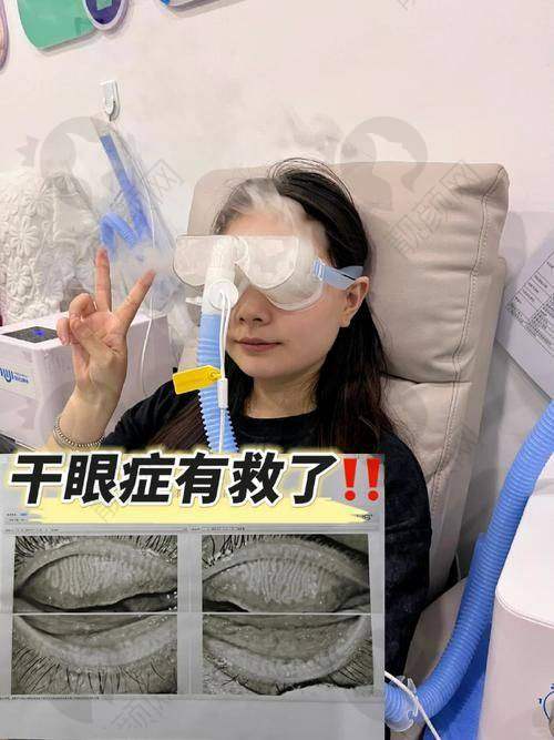 玉林华厦眼科医院干眼治疗项目优势