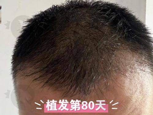 碧莲盛北京分院：靠谱医生团队实力强