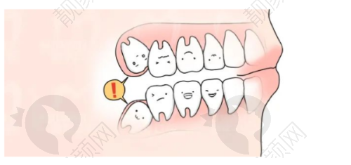 玉溪舒尔口腔价格:性价比之选