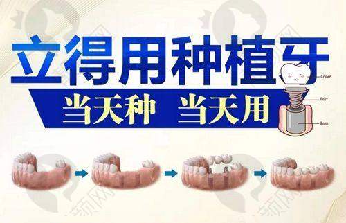 玉溪舒尔口腔根管治疗相关医生介绍